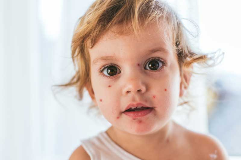 Kennisquiz Kinderkwaaltjes